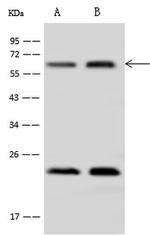 AdoHcyase 2 Antibody in Western Blot (WB)