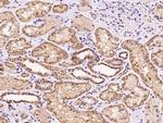 MRPL20 Antibody in Immunohistochemistry (Paraffin) (IHC (P))