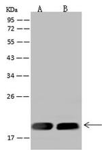 MRPL20 Antibody in Western Blot (WB)