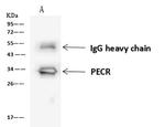 PECR Antibody in Immunoprecipitation (IP)