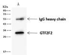 GTF2F2 Antibody in Immunoprecipitation (IP)