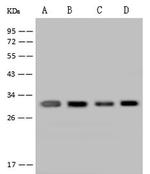 GTF2F2 Antibody in Western Blot (WB)