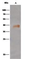 LGMN Antibody in Immunoprecipitation (IP)