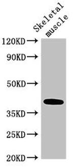 ABO Antibody in Western Blot (WB)