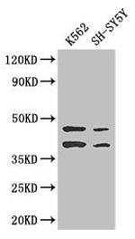 AIM2 Antibody in Western Blot (WB)