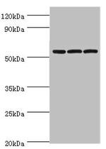 alpha Amylase 2B Antibody in Western Blot (WB)