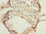 CMG2 Antibody in Immunohistochemistry (Paraffin) (IHC (P))