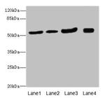 CMG2 Antibody in Western Blot (WB)