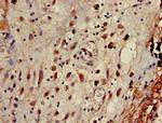 gamma Adaptin Antibody in Immunohistochemistry (Paraffin) (IHC (P))