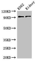 gamma Adaptin Antibody in Western Blot (WB)