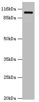 AP2A2 Antibody in Western Blot (WB)