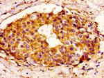 BCL-3 Antibody in Immunohistochemistry (Paraffin) (IHC (P))