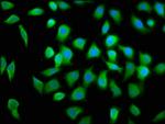 eIF4A2 Antibody in Immunocytochemistry (ICC/IF)