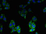 BLOC1S1 Antibody in Immunocytochemistry (ICC/IF)