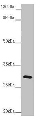 CENPH Antibody in Western Blot (WB)