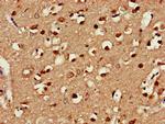 ENTH Antibody in Immunohistochemistry (Paraffin) (IHC (P))