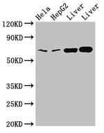 ENTH Antibody in Western Blot (WB)