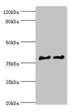 Cathepsin V Antibody in Western Blot (WB)