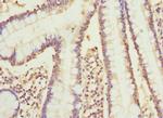 CYP2C18 Antibody in Immunohistochemistry (Paraffin) (IHC (P))