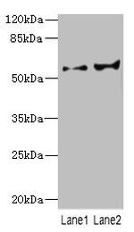 CYP2C18 Antibody in Western Blot (WB)