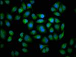 CYP2C19 Antibody in Immunocytochemistry (ICC/IF)