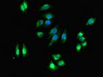 DHRS3 Antibody in Immunocytochemistry (ICC/IF)