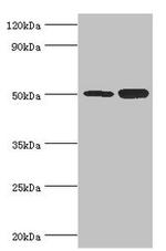 EED Antibody in Western Blot (WB)