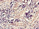 eIF4A3 Antibody in Immunohistochemistry (Paraffin) (IHC (P))