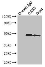 ENTPD5 Antibody in Immunoprecipitation (IP)