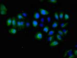 EphA5 Antibody in Immunocytochemistry (ICC/IF)