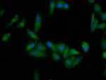 EPRS Antibody in Immunocytochemistry (ICC/IF)