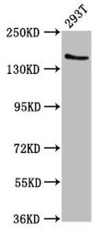 EPRS Antibody in Western Blot (WB)