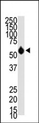 HDAC8 Antibody in Western Blot (WB)