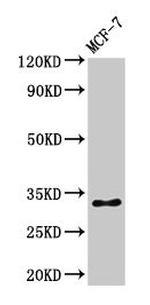 Phospho-Histone H1.5 (Ser17) Antibody in Western Blot (WB)