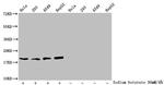 Acetyl-Histone H1.2 (Lys84) Antibody in Western Blot (WB)