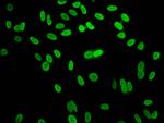 Mono-Methyl-Histone H1.2 (Lys96) Antibody in Immunocytochemistry (ICC/IF)