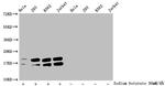 Acetyl-Histone H1.2 (Lys96) Antibody in Western Blot (WB)