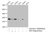 Phospho-Histone H1.4 (Thr17) Antibody in Western Blot (WB)