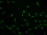 Crotonyl-Histone Macro-H2A.1 (Lys118) Antibody in Immunocytochemistry (ICC/IF)