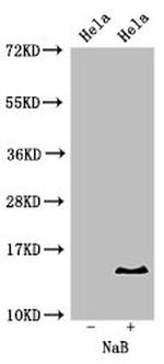 H2BK16ac Antibody in Western Blot (WB)