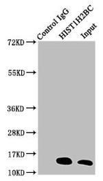 H2BK20ac Antibody in Immunoprecipitation (IP)