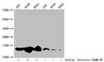 H2BK20ac Antibody in Western Blot (WB)