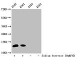 2-hydroxyisobutyryl-Histone H2B (Lys34) Antibody in Western Blot (WB)