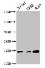 H3K27me3 Antibody in Western Blot (WB)