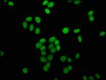 Butyryl-Histone H4 (Lys16) Antibody in Immunocytochemistry (ICC/IF)