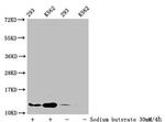 Butyryl-Histone H4 (Lys16) Antibody in Western Blot (WB)