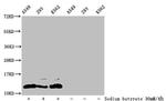 Formyl-Histone H4 (Lys77) Antibody in Western Blot (WB)