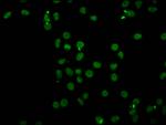 H4K91ac Antibody in Immunocytochemistry (ICC/IF)