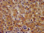 HMGCS2 Antibody in Immunohistochemistry (Paraffin) (IHC (P))