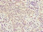 HOXD10 Antibody in Immunohistochemistry (Paraffin) (IHC (P))